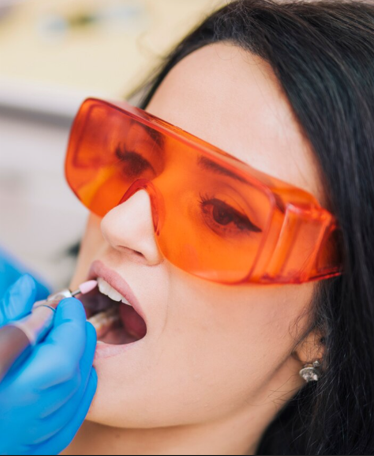 Oxygen Whitening Therapy