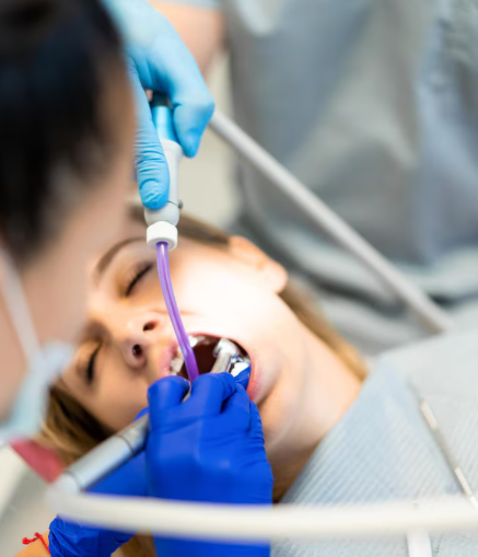 Ozone-Assisted Dental Cleaning