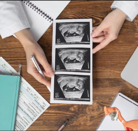 Placenta Previa & Accreta Management Pathway