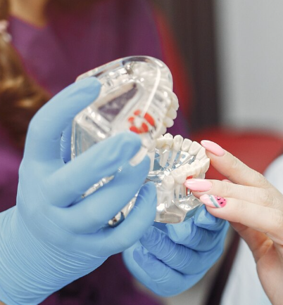 Quick Fit Single Implant