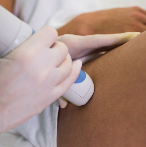 Laser Vaginal Tightening Therapy