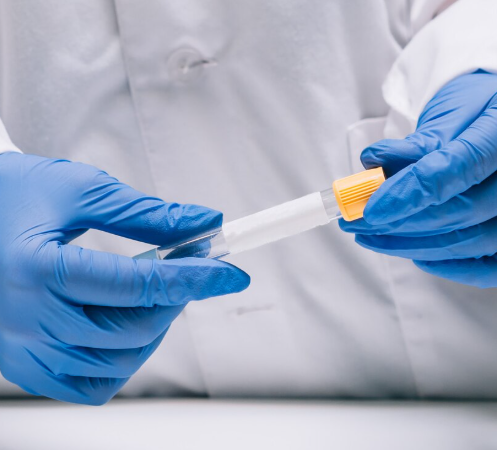 STI Antibody Testing