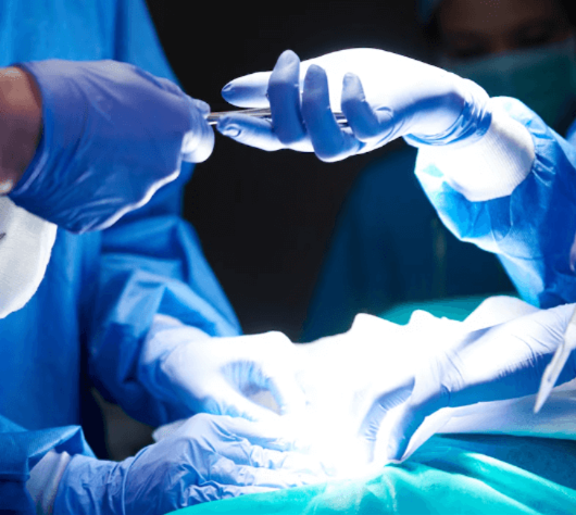 Single-Port Fibroid Removal Surgery