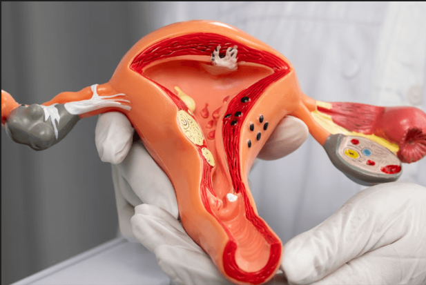 Same-Day IUD Insertion