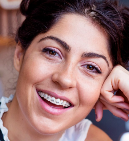 Orthodontic Smile Rebalance