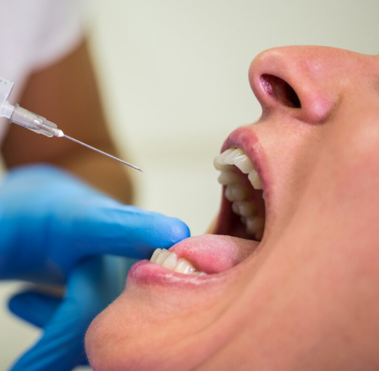 Connective Tissue Graft