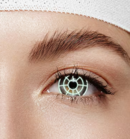 Custom Toric Lens Alignment Surgery