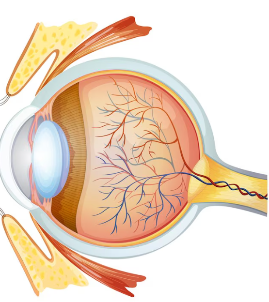 Laser Peripheral Iridoplasty