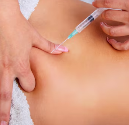 ContourFix Fat Dissolving Injection