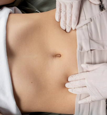 CoreSculpt Abdominal Fat Reduction