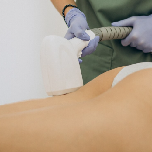 High-Intensity RF Body Slimming