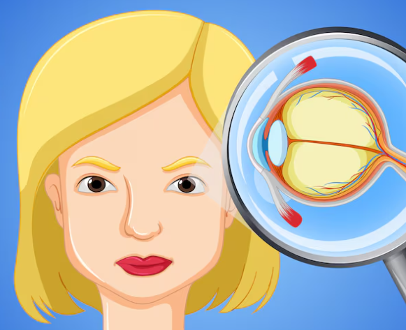 Posterior Vitreous Detachment Management