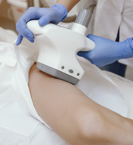 UltraShape Cellulite Reduction Treatment